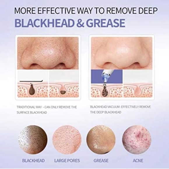 DermaSuction Pre Cleaning Device - Picture 6 of 11